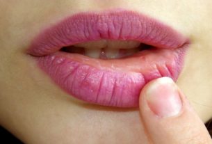 lipstick dry chapped