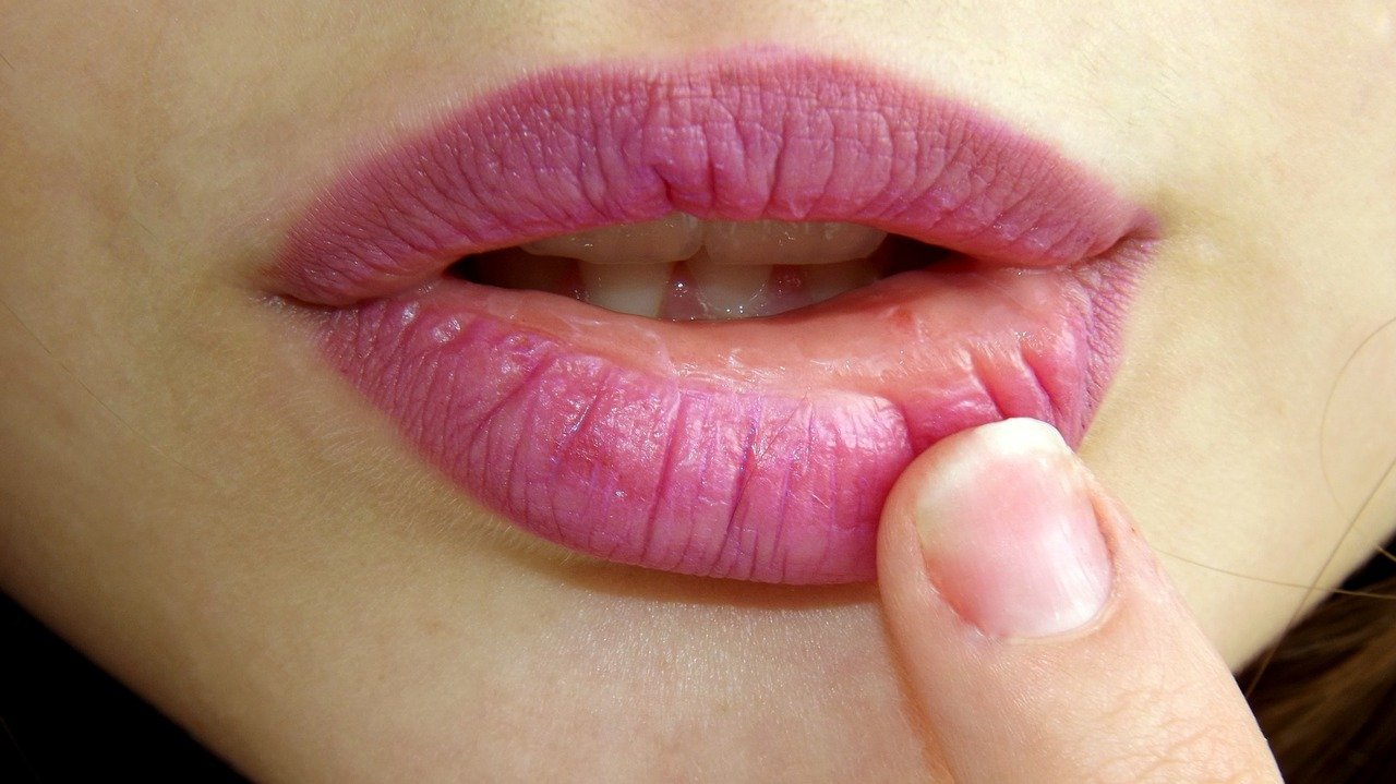 lipstick dry chapped